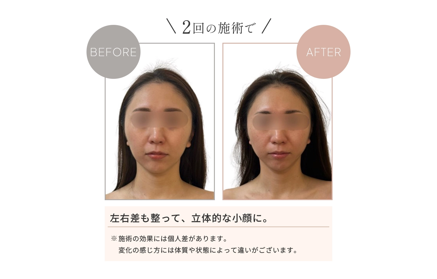 2回の施術で