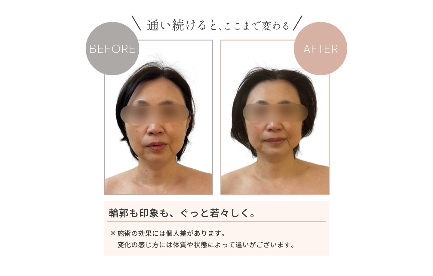 通い続けると、ここまで変わる