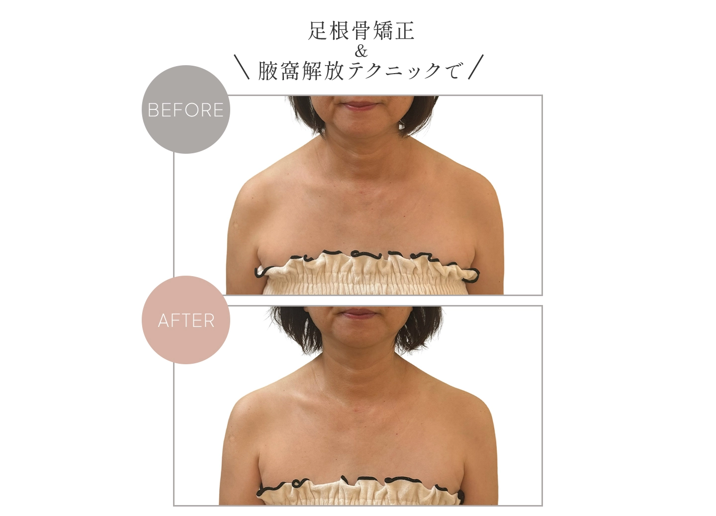 足根骨矯正&腋窩解放テクニックで